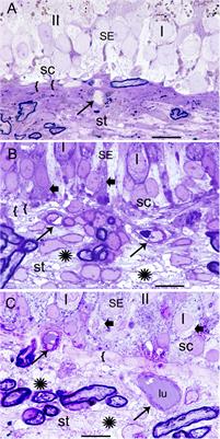 Oxidative Stress in the Blood Labyrinthine Barrier in the Macula Utricle of Meniere’s Disease Patients